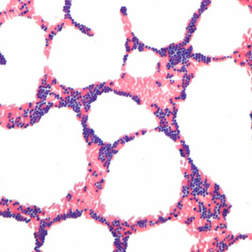 Merck 111885 Gram Boyası Seti, Gram-Color Stain set for the Gram staining method 5 x 500 mL