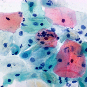 Merck 106888 Papanicolaou Çözeltisi 2A Orange G Çözeltisi (Og 6) Cytoplasm Staining Of Mature And Keratinized Cells İn Cytology  2.5 L
